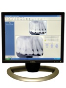 Digital X-rays - Less Radiation